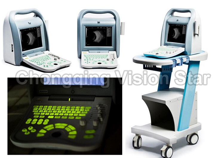 China ODU-8 Ophthalmic A and B Scan Best Price Supplier, Medical 