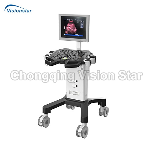 UBW350 Black and White Trolley Ultrasound Scanner