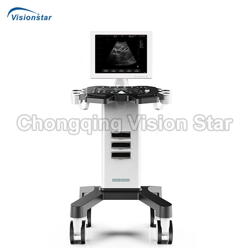 UBW370 Full-Digital Black and White Trolley Ultrasound