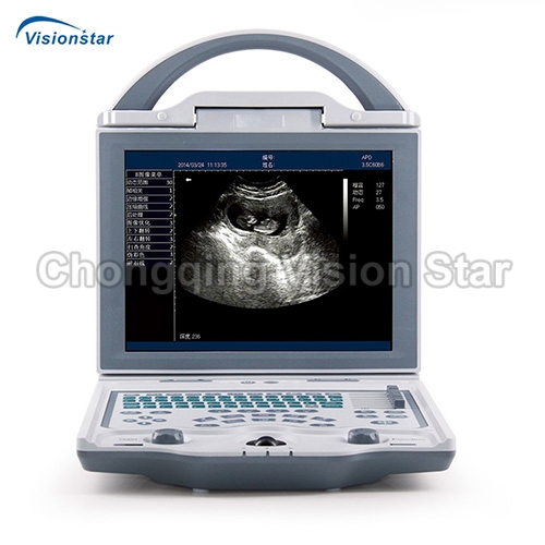 UBW5600 B/W Laptop Ultrasound Machine