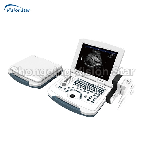 UBW580 Full-Digital Laptop Ultrasound Machine