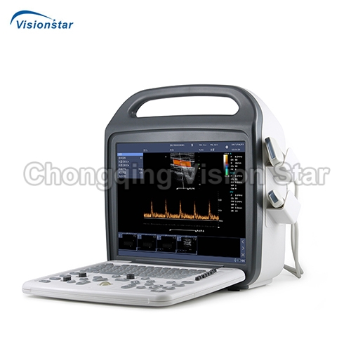 UCD10 Portable Color Doppler Ultrasound Machine