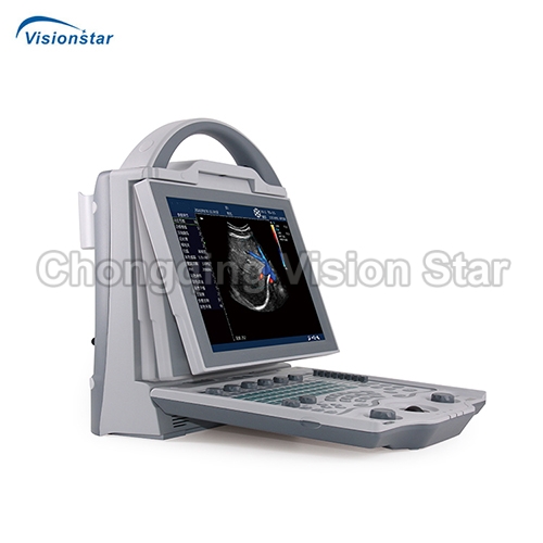 UCD12 Portable Laptop Color Doppler Ultrasound Machine