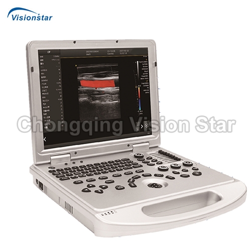 UCD3L Laptop Color Doppler Ultrasound Scanner