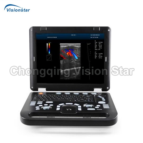 UCD50 Laptop Color Doppler Ultrasound Machine