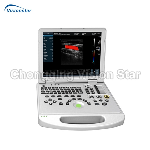 UCD5L Laptop Color Doppler Portable Ultrasound Scanner