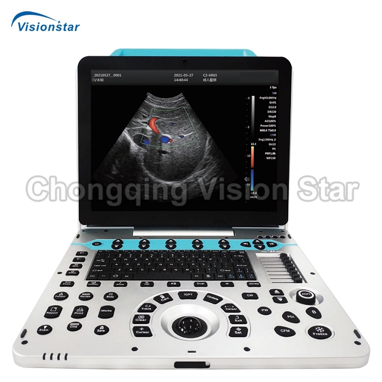 UCD5P Color Doppler Portable Ultrasound Scanner