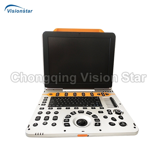 UCD6P 4D Color Doppler Portable Ultrasound Machine