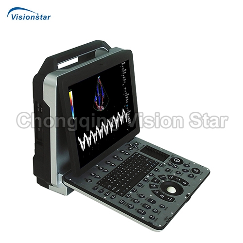 UCD8P 4D Echo Portable Color Doppler Ultrasound Machine