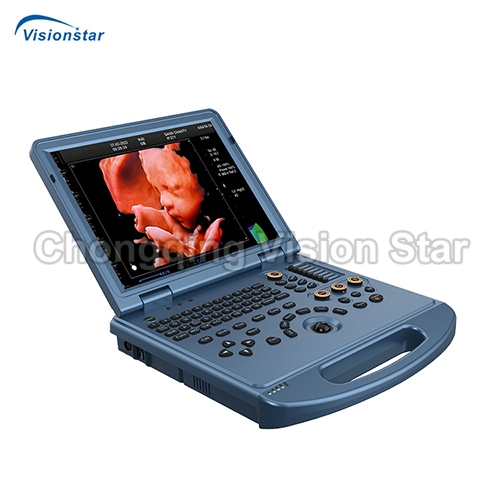 UCD50L 4D Laptop Color Doppler Ultrasound Machine