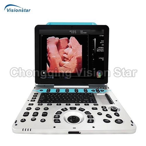 UCD50P Portable 5D Color Doppler Ultrasound Machine