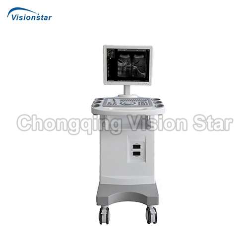 UBW1100 Trolley B/W Ultrasound Scanner