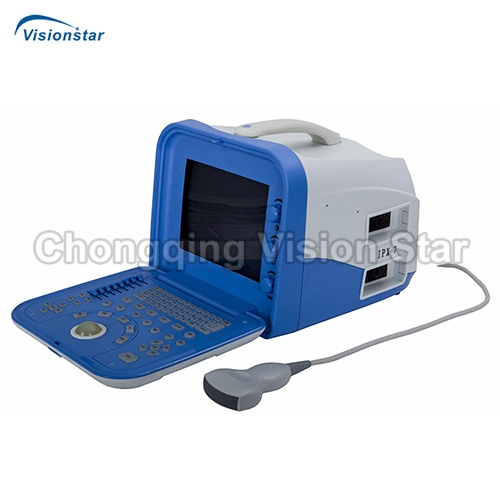 UBW1288V Portable B/W Ultrasound Scanner