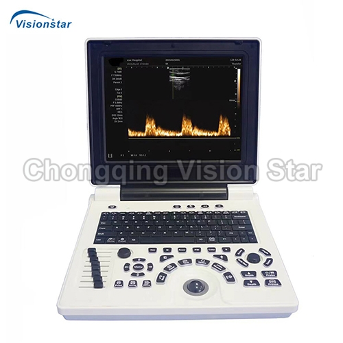 UBW20P Laptop B/W Ultrasound Scanner