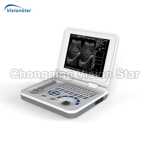 UBW30 Laptop Type B/W Ultrasound Scanner