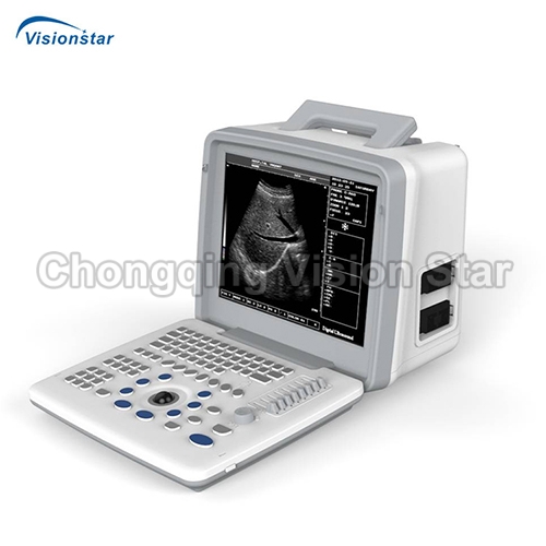 UBW300 Portable Type B/W Ultrasound Scanner