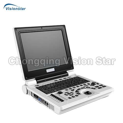 UBW30B Laptop Type B/W Ultrasound Scanner