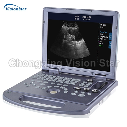 UBW360 Laptop B/W Ultrasound Scanner