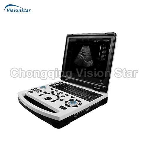 UBW690 Laptop Type B/W Ultrasound Scanner