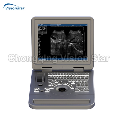 UBW70A Notebook B/W Ultrasound Scanner