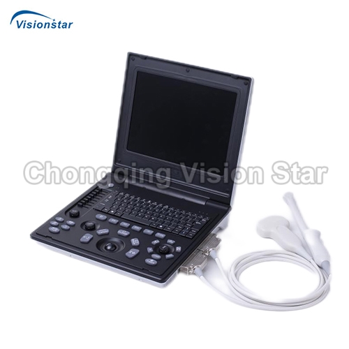 UBW7K Laptop B/W Ultrasound Machine