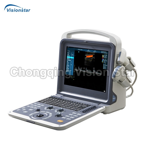 UCD01 Portable Color Doppler Ultrasound Scanner