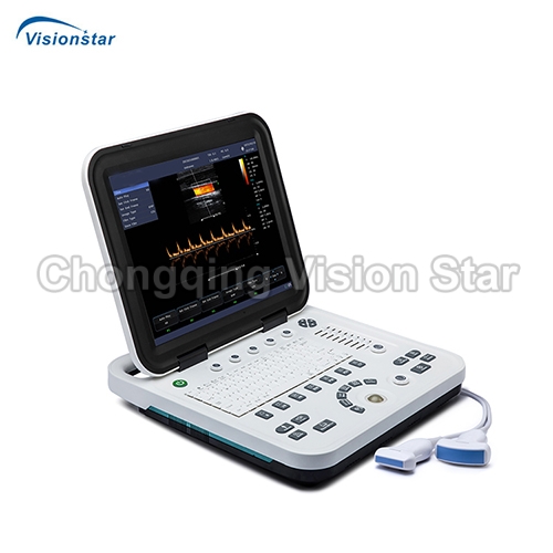 UCD1C Laptop Color Doppler Ultrasound Scanner