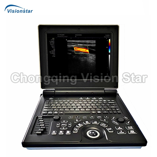 UCD20E Laptop Color Doppler Ultrasound