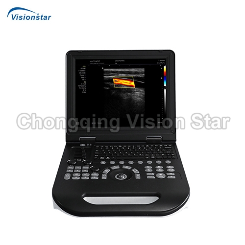 UCD30E Laptop Color Doppler Ultrasound