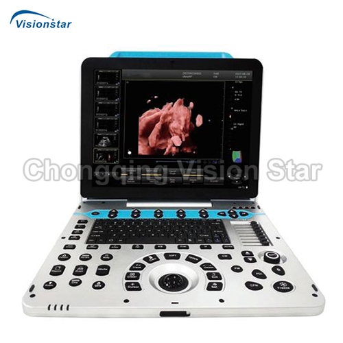 UCD30P Portable 4D Color Doppler Ultrasound Machine