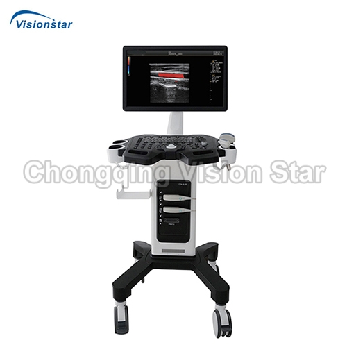 UCD3F Trolley Type Color Doppler Ultrasound Machine