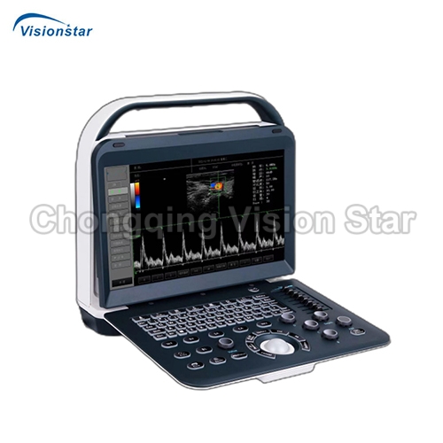 UCD50C Laptop Color Doppler Ultrasound Scanner