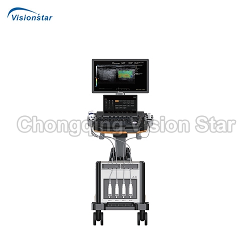 UCD60T 4D Trolley Color Doppler Ultrasound Scanner