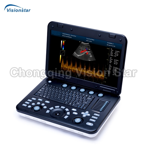 UCD7C Laptop Color Doppler Ultrasound Scanner