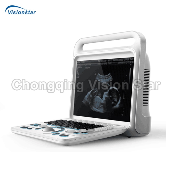 UCD60E Portable Color Doppler Ultrasound Scanner