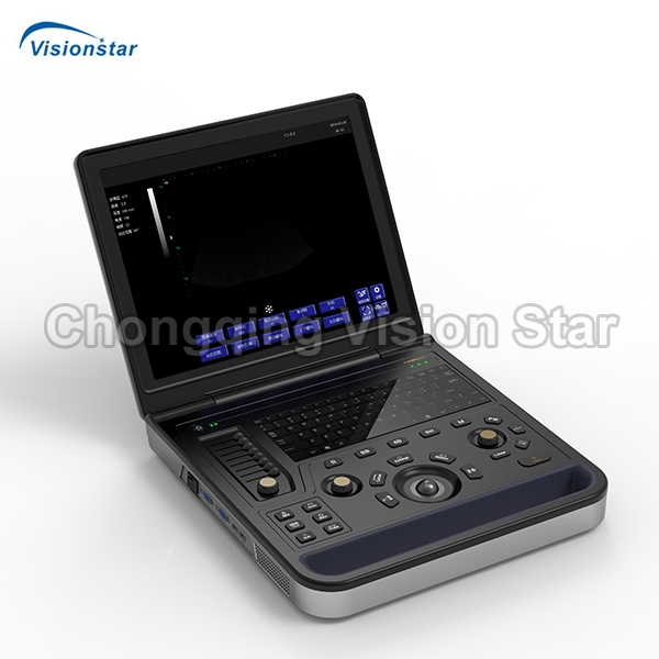 UBW9K Laptop B/W Ultrasound Scanner(PW Optional)