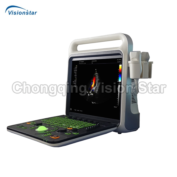 UCD60C Portable Color Doppler Ultrasound Scanner